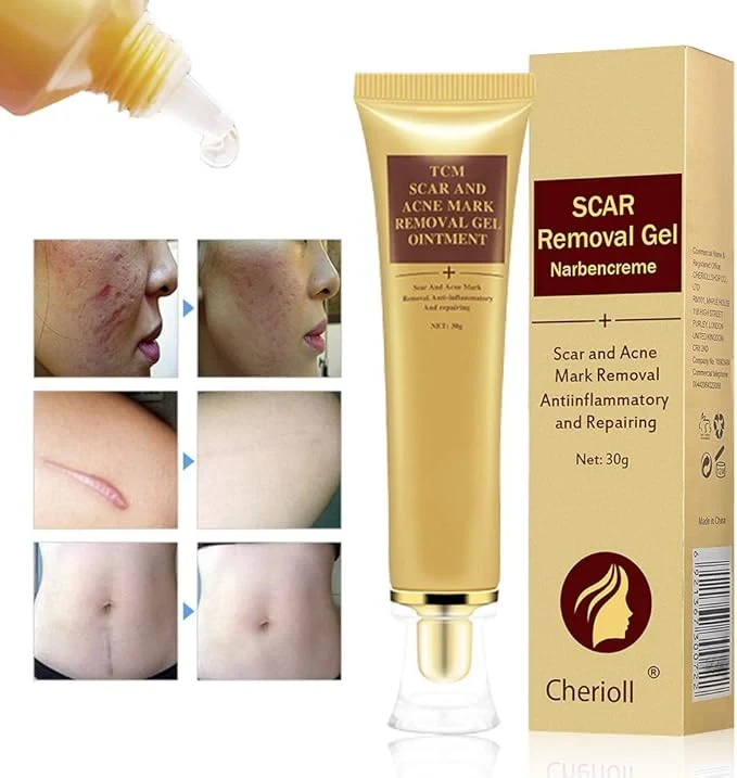 Scar, Stretch And Acne Mark Removal Gel Ointment 30GM